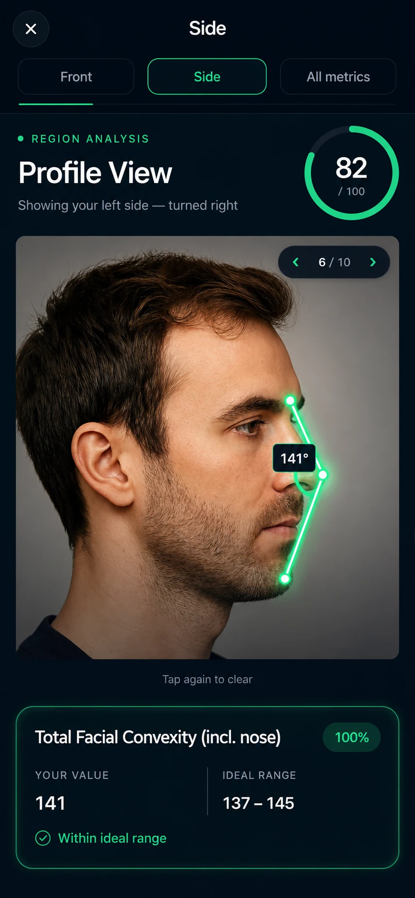 GlowAI side profile analysis showing the total facial convexity angle measured from the scan